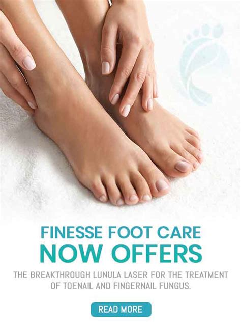 foot finesse near me|finesse foot care cost.